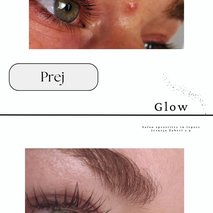 Glow, salon sprostitve in lepote, Jerneja Žaberl s.p. - kozmetični salon, prehransko svetovanje, wellness - 2