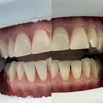 Omega zobozdravstvo d.o.o. - zobozdravstvene storitve, fizioterapija - 11